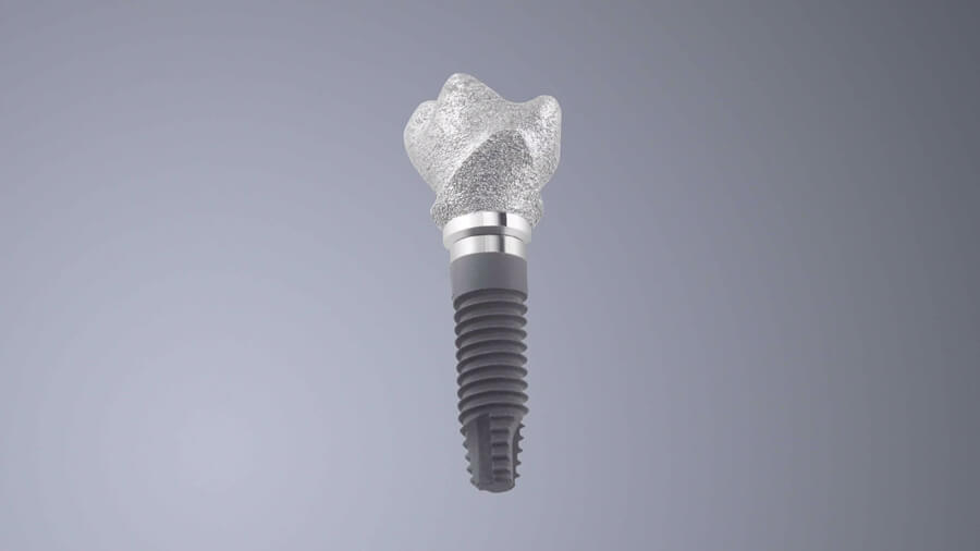 SINGLE ABUTMENT INDIVIDUALI CON PREFORMA DENTALE