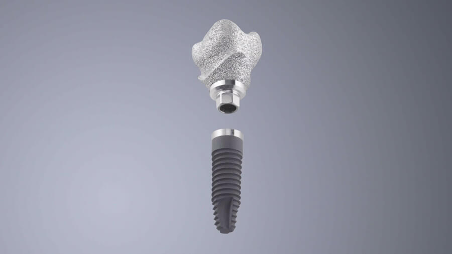 SINGLE ABUTMENT INDIVIDUALI CON PREFORMA DENTALE